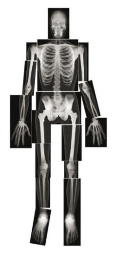 Röndgenove fotky ľudského tela